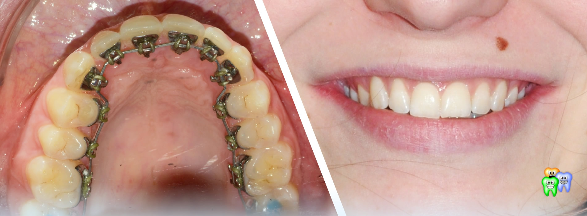 Clinica Ortodontica Palermo