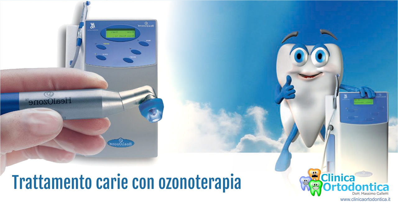 Trattamento carie con ozonoterapia
