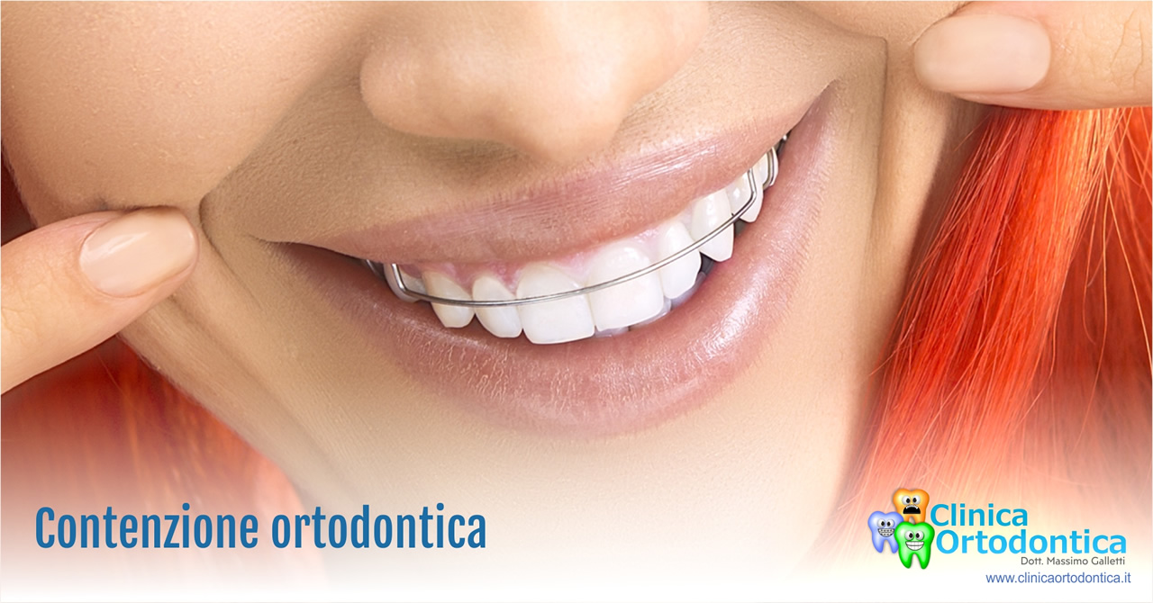 Contenzione ortodontica Palermo