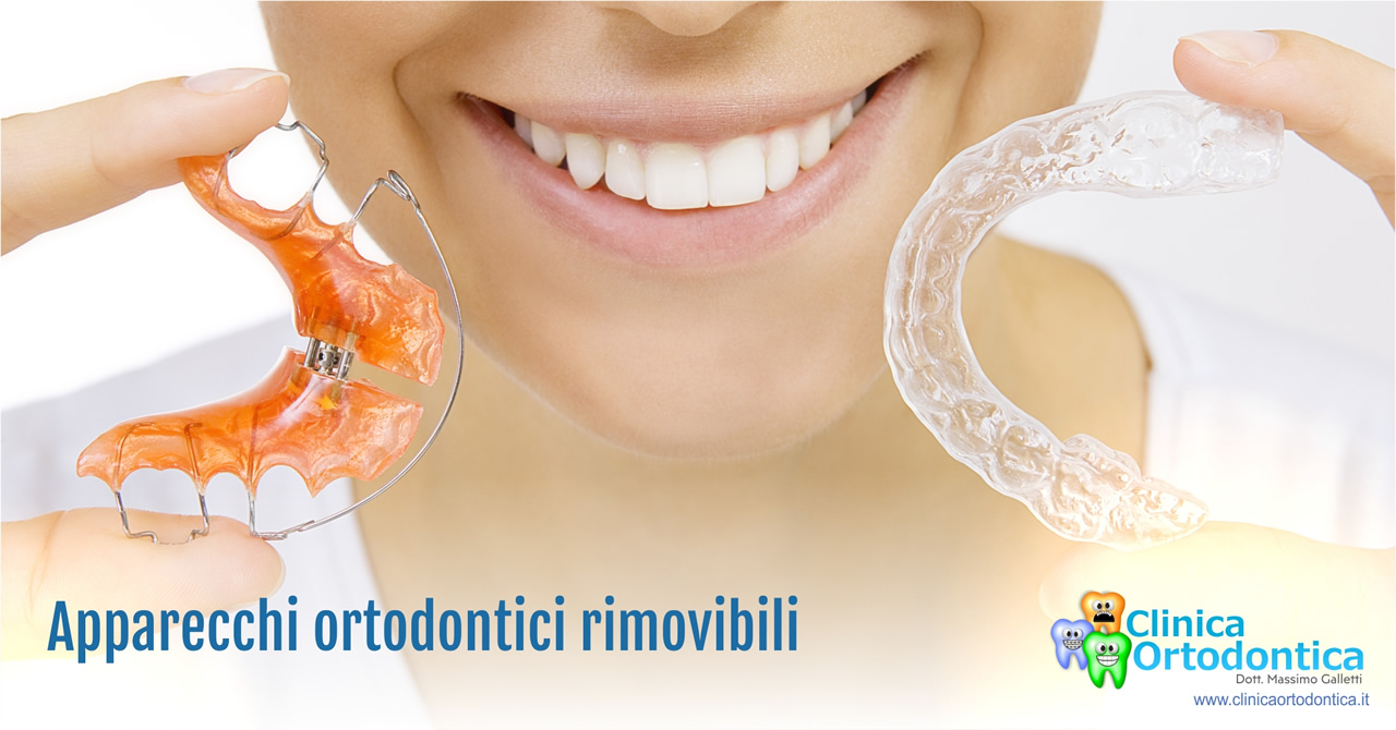 Apparecchi ortodontici rimovibili